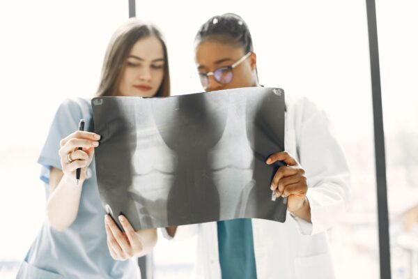 Fracture du plateau tibial : temps de guérison et reprise de la marche